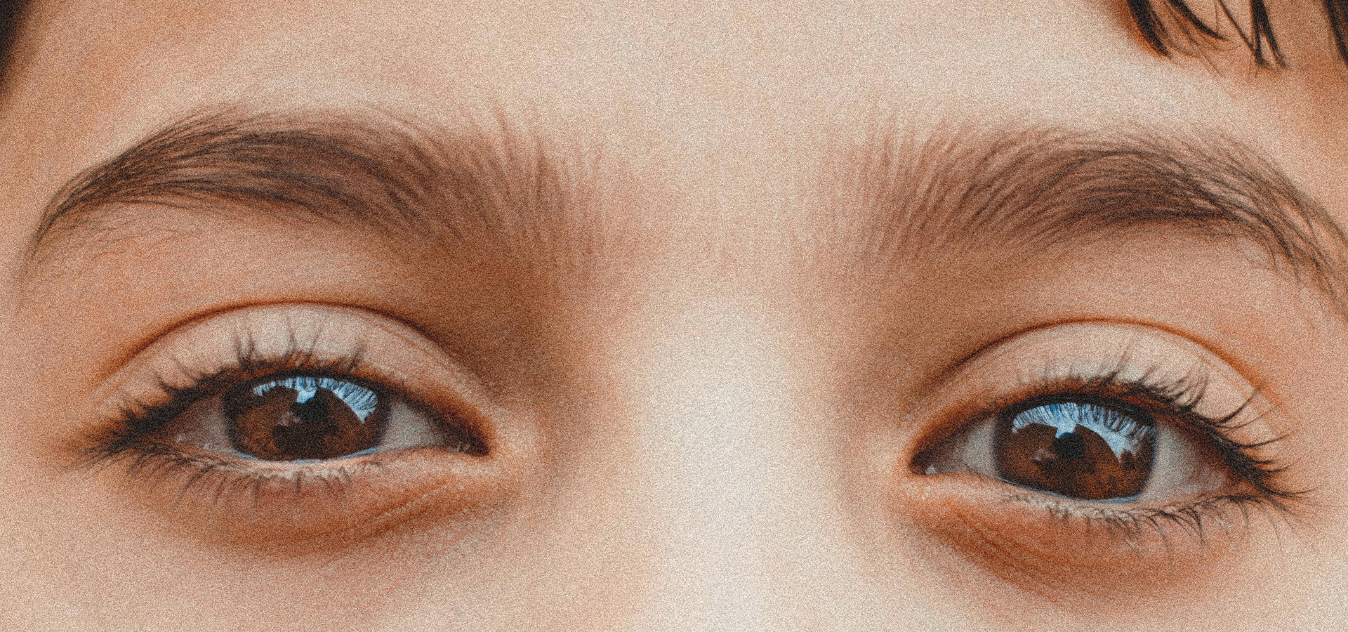 Among all eye colours, brown eyes are the most common 2