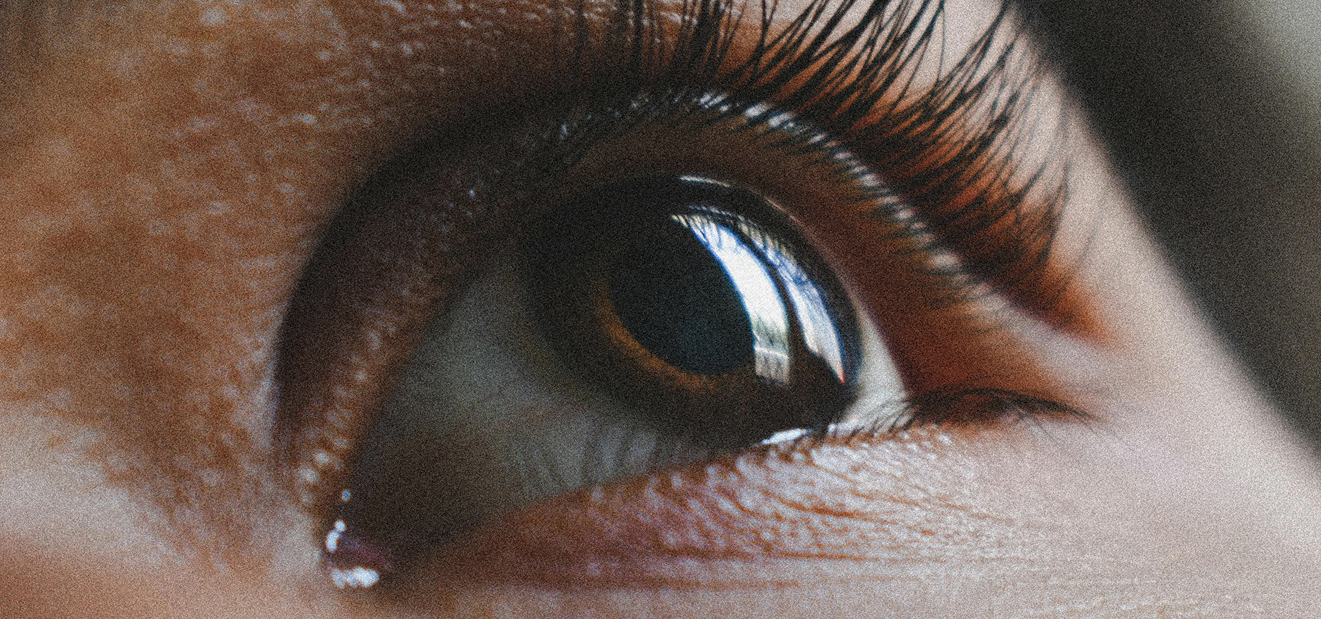 Among all eye colours, brown eyes are the most common 1