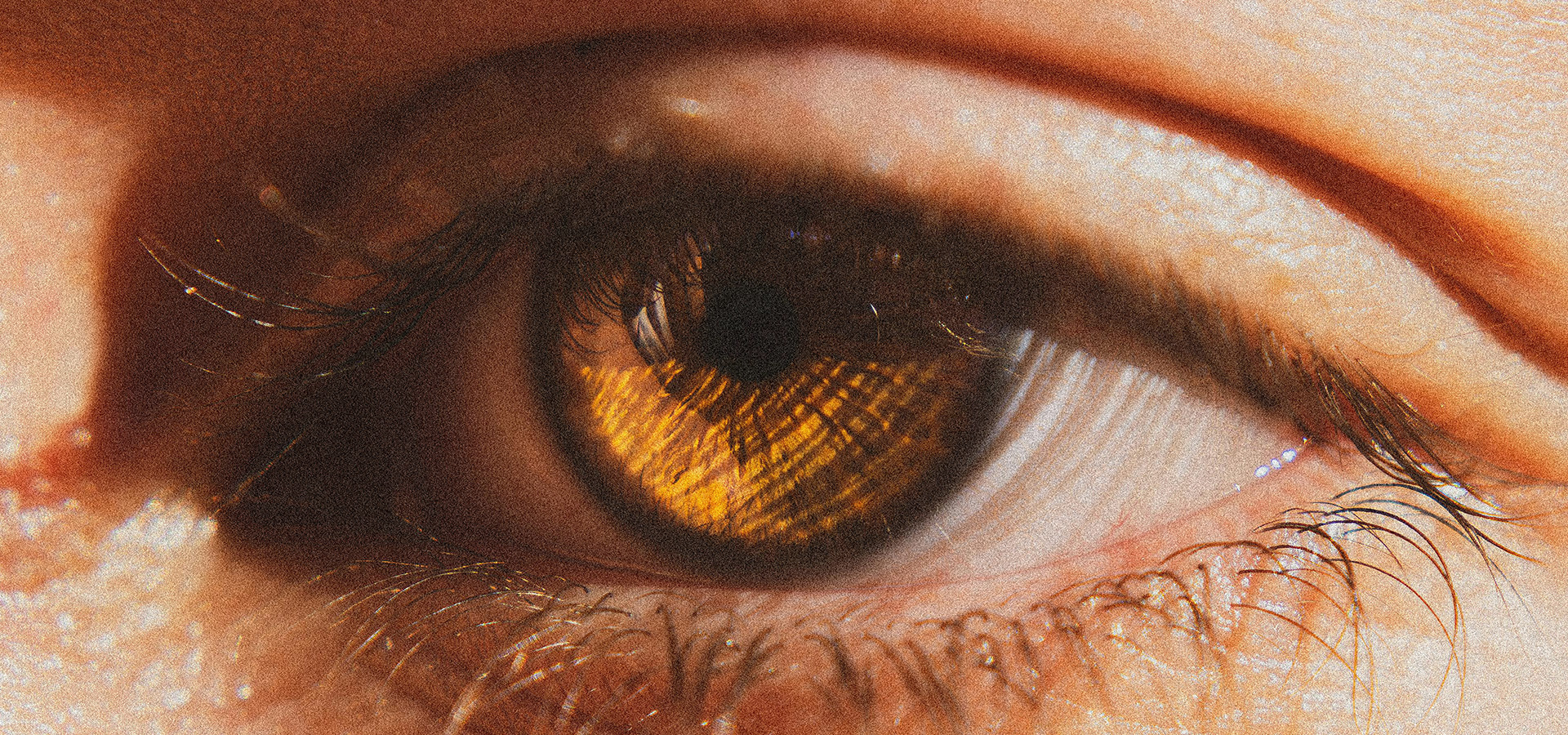 Among all eye colours, brown eyes are the most common 3